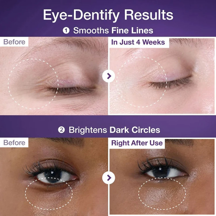 کرم دور چشم نامبوزین NUMBUZIN NAD+ RETINOL VOLUMETOX EYE CREAM